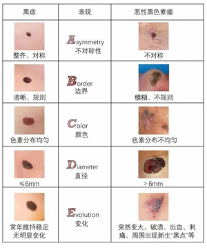 体内有肿块是什么症状（22岁女孩体内有上千颗肿瘤，痛到只能半跪在床，脖子无法自由扭动）